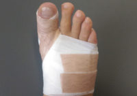 Болит палец на ноге после операции это