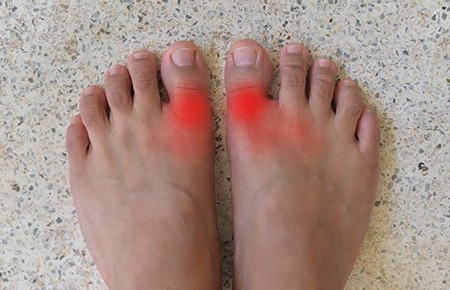 Боли в пальце ноги – симптом, указывающий на опасные болезни. Читайте ниже…